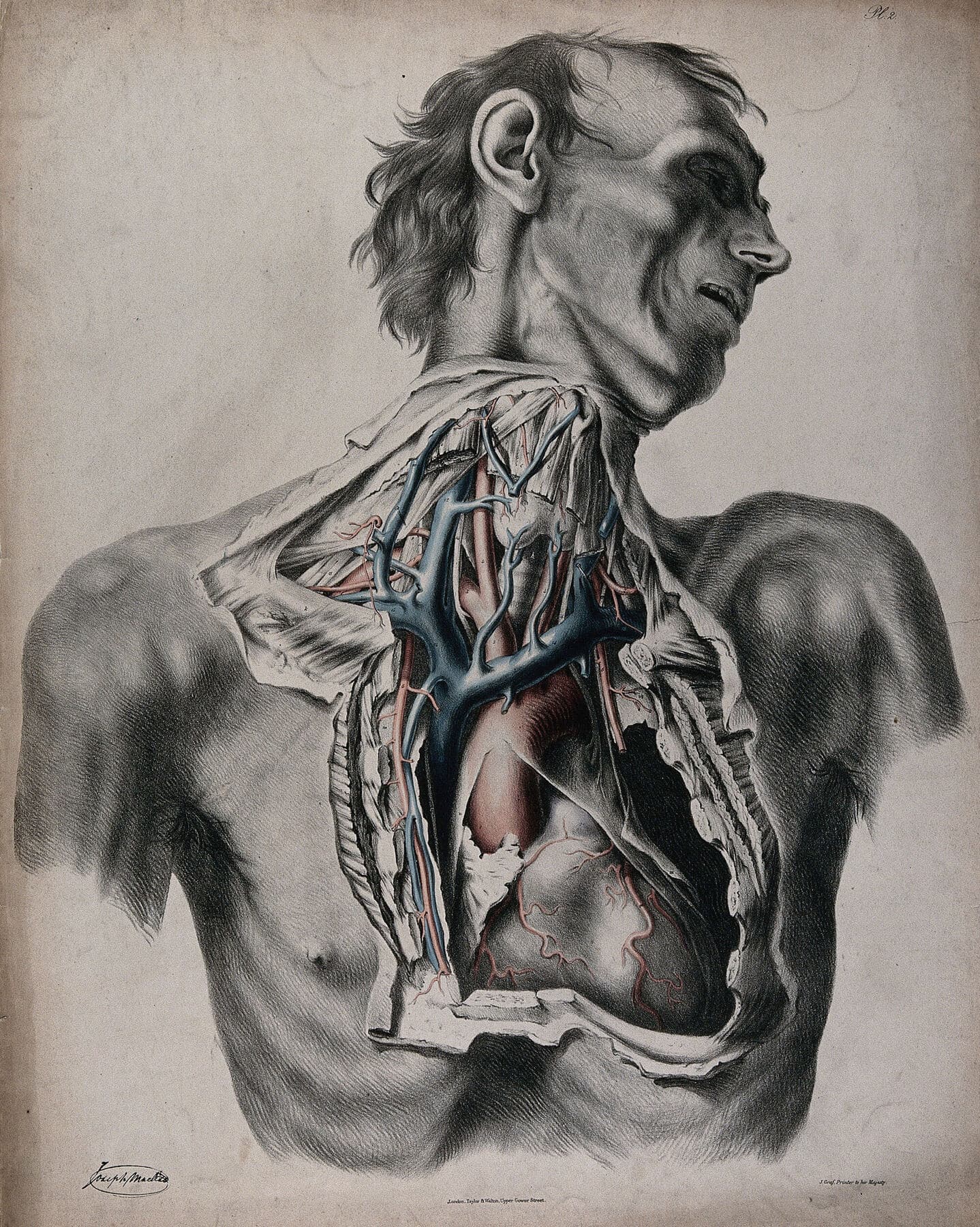 A hand-coloured anatomical plate of a man's chest and neck opened to show the heart, with the great arteries in red and veins in blue running straight up from it into the neck and towards the head.
